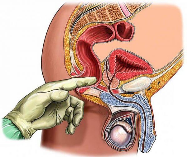 Растяжка ануса или как растянуть анальное отверстие