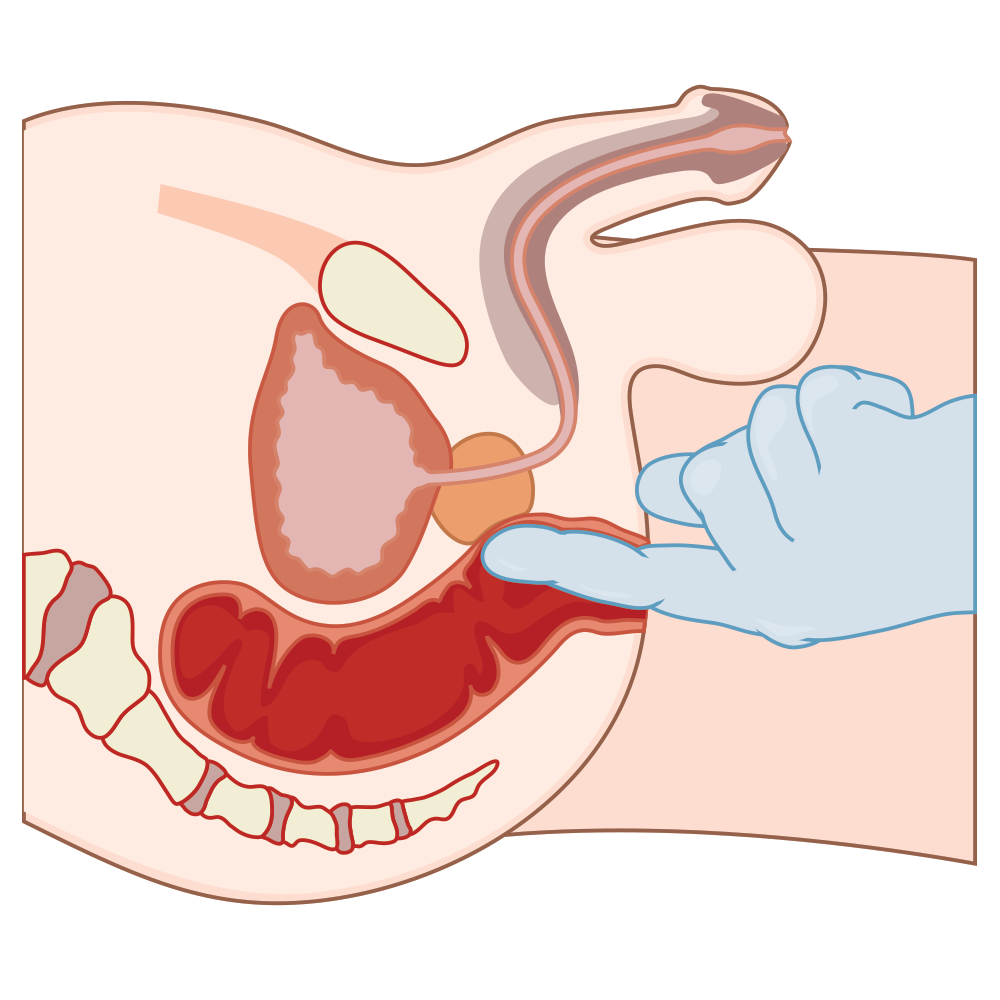 Массаж простаты пальцем. Смотреть массаж простаты пальцем онлайн